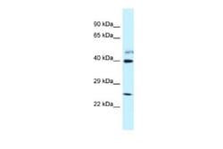 GRINL1A Rabbit anti-Human, Polyclonal, Novus Biologicals 0.1 mL | Buy Online | Novus Biologicals | Fisher Scientific